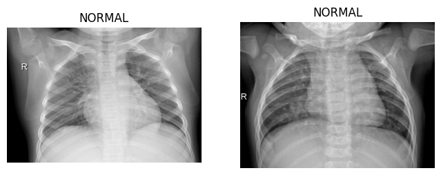 Normal X-Ray